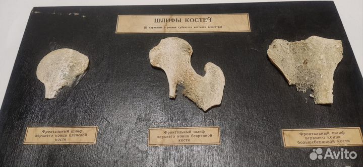 Шлифы костей (наглядное пособие)