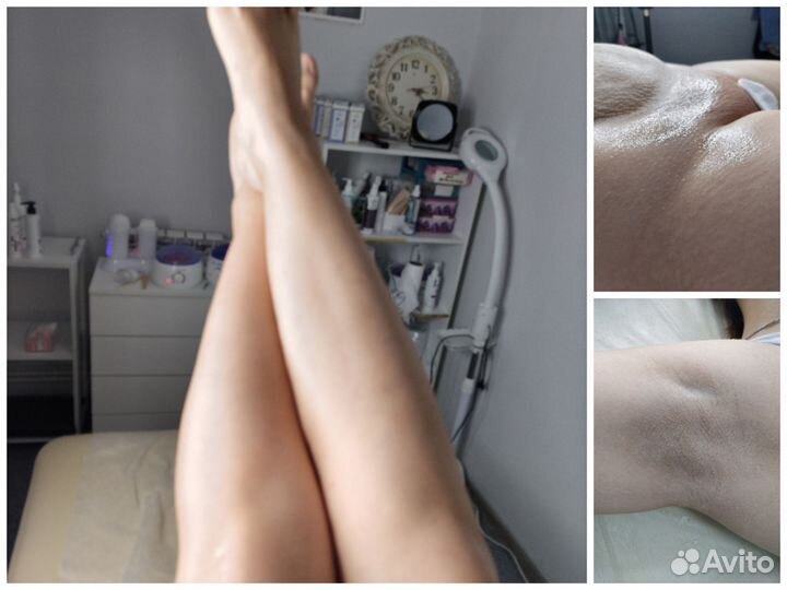 Восковая депиляция