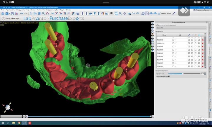 Хирургический шаблон RealGuide,BlueSkyPlan,ExoCad