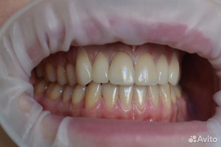 Зубной техник, керамист, exocad, заведующий зтл