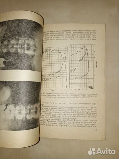 Радиоизотопная диагностика заболеваний мочевой сис