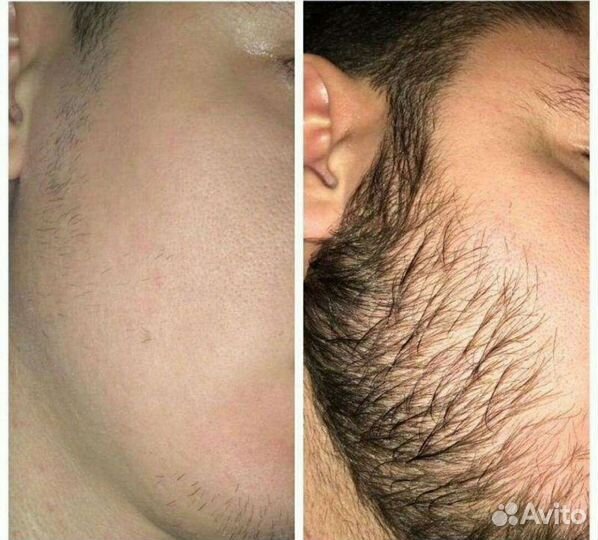 Оригинальный minoxidil Kirkland 5