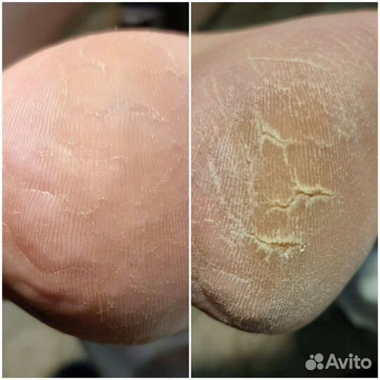 Наращивание/коррекция ногтей. Маникюр. Педикюр