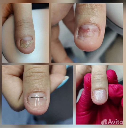 Подолог, Медицинский педикюр, Услуги подолога