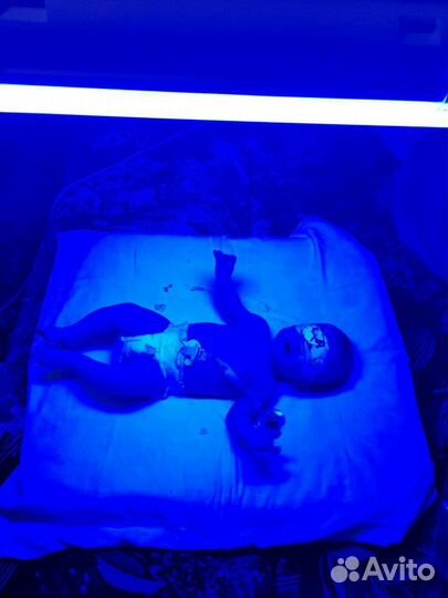 Аренда лампы для лечения желтушки у новорождённых