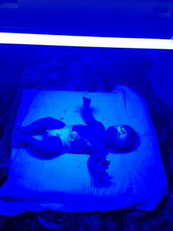 Аренда лампы для лечения желтушки у новорождённых