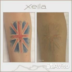 Удаление татуировки лазером PicoSure