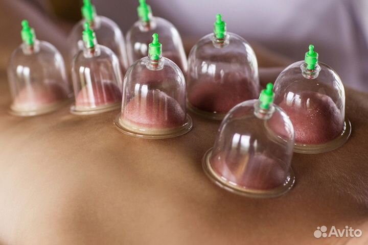 Хиджама углубленное обучение/практикум