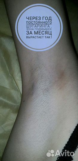 Шугаринг с выездом