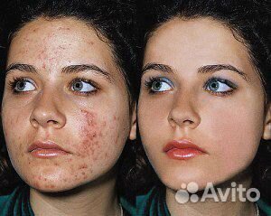 Грузинский крем