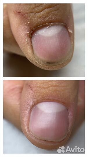 Маникюр и Педикюр в 4 руки Балтрайон