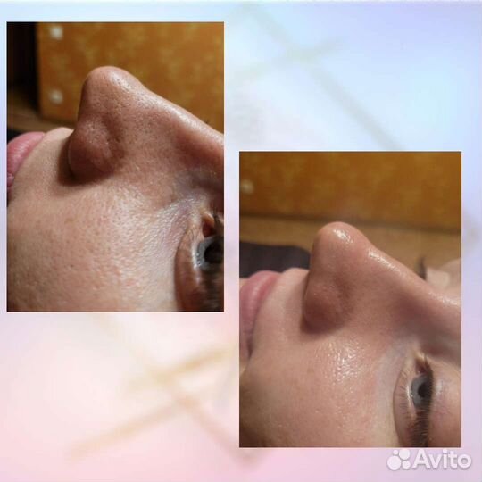 Услуги косметолога