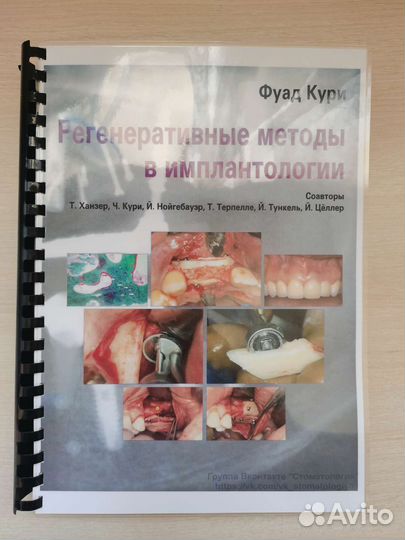 Регенеративные методы в имплантологии