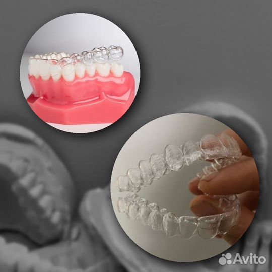 Каппа на зубы