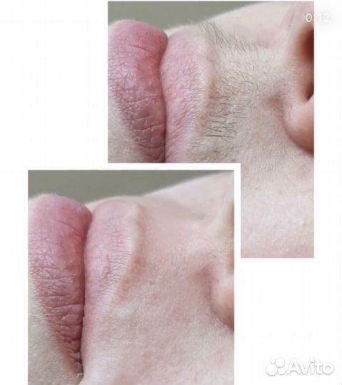 SPA-шугаринг,восковая депиляция, коррекция бровей