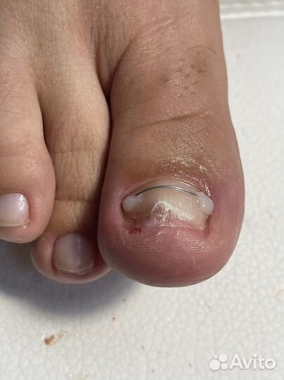 Подолог Педикюр Маникюр Гель лак Наращивание