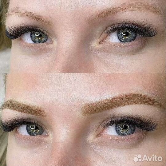 Удаление и исправление татуажа бровей