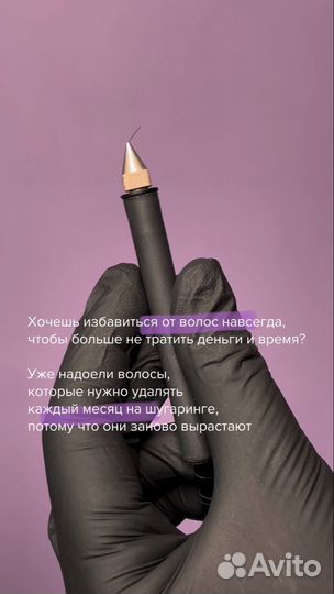 Электроэпиляция