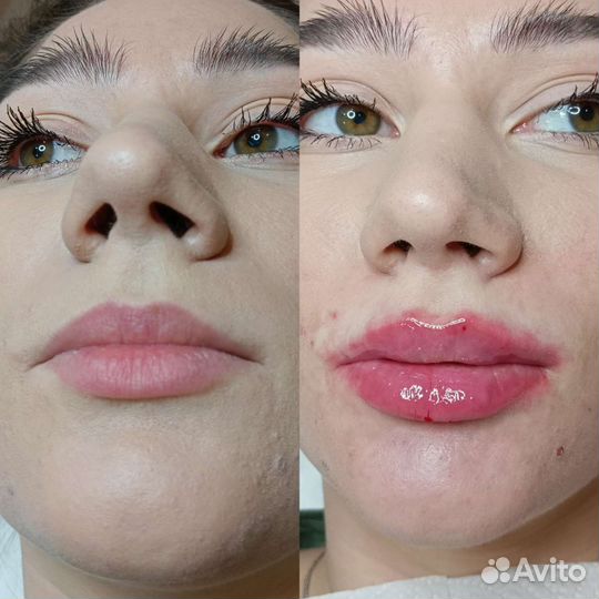 Косметология в Кабардинке