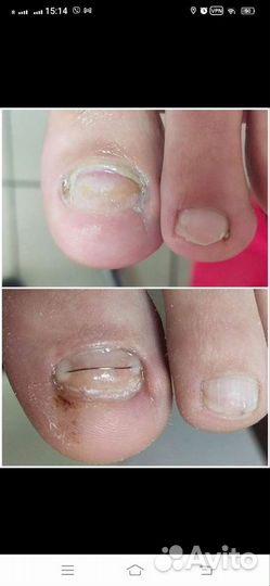 Подолог с опытом работы