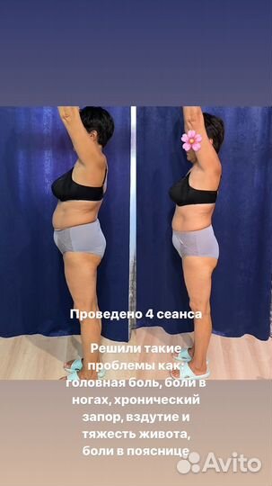 Висцеральные правки/Моделирующий массаж