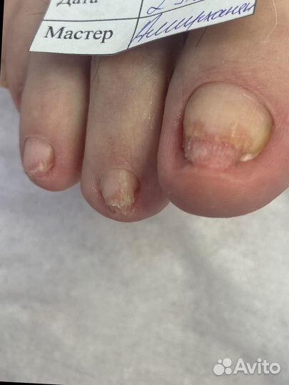 Маникюр,педикюр, подолог с выездом