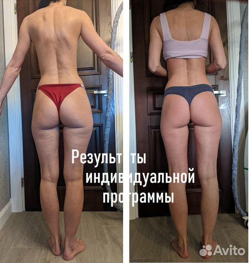 Коррекция фигуры (аппаратная:LPG,Turbo и много др)