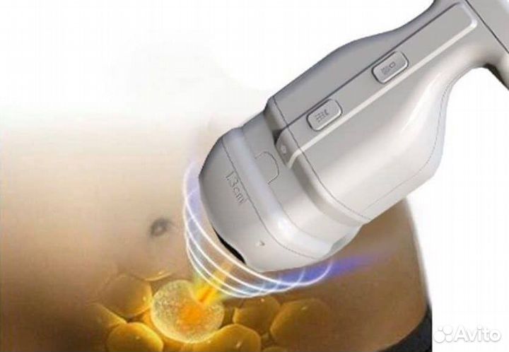 Липосоникс, лазерный липолиз