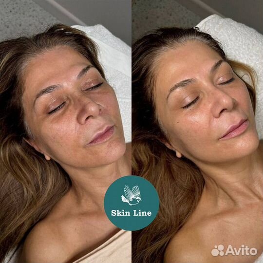 Модели / микротоки / омолаживание