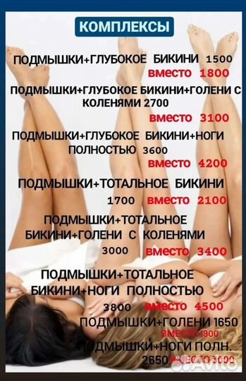 Лазерная эпиляция