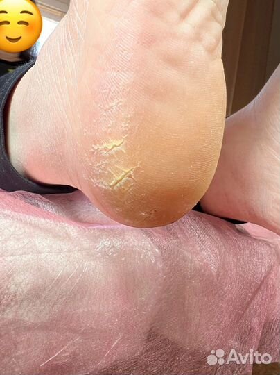 Аппаратный маникюр