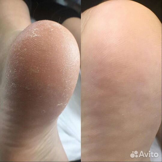 Маникюр Педикюр