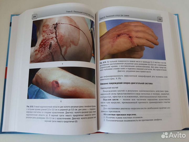 Экстренная медицинская помощь при острых заболеван