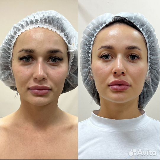 Ручная и Аппаратная коррекция лица и фигуры