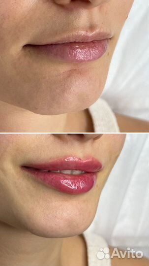 Косметолог Подольск Массаж Чистка лица Ботокс