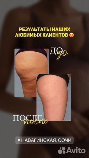 Продам студию коррекции фигуры и массажа