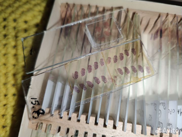 Гистологическое препараты