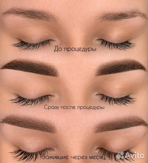 Перманентный макияж Татуаж Лазерное удаление