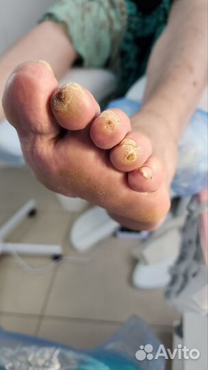 Услуги подолога