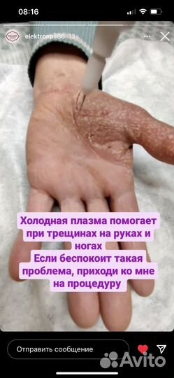 Холодная плазма