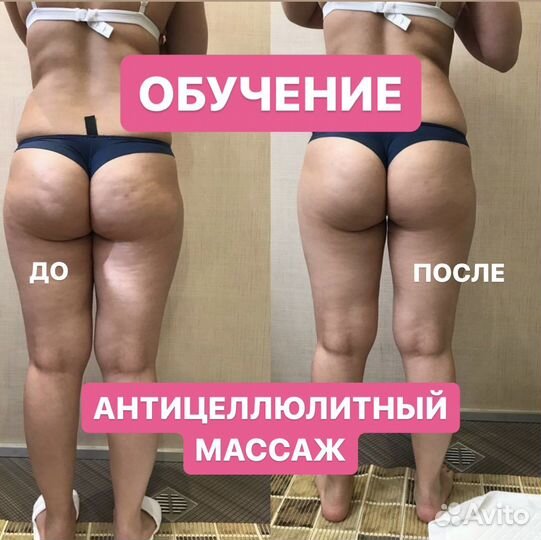 Антицеллюлитный массаж обучение