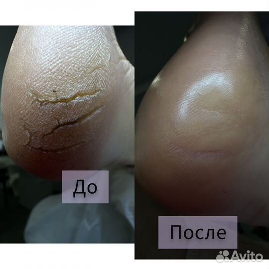 Смарт педикюр, маникюр