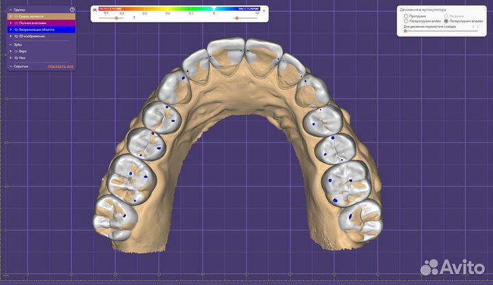 Моделировка в Exocad