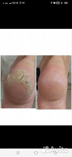 Подолог с опытом работы