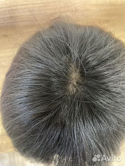 Система замещения волос