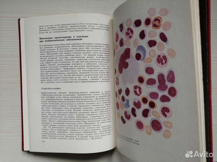 Гематологический атлас (1979г.) / А. Абрамов