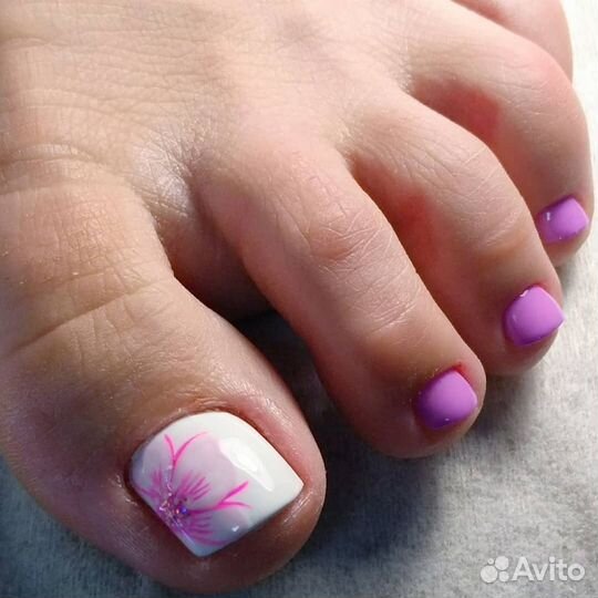 Педикюр(медицинский) Выезд