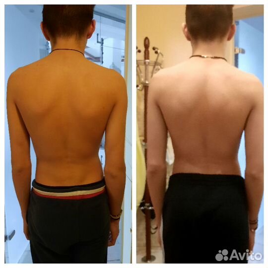 Массаж. Кинезиолог. Кинезиомассаж. Тейпирование