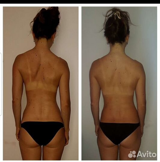 Массаж по триггерным точкам+лфк с мед.образованием