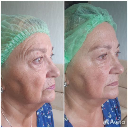 Массаж лица